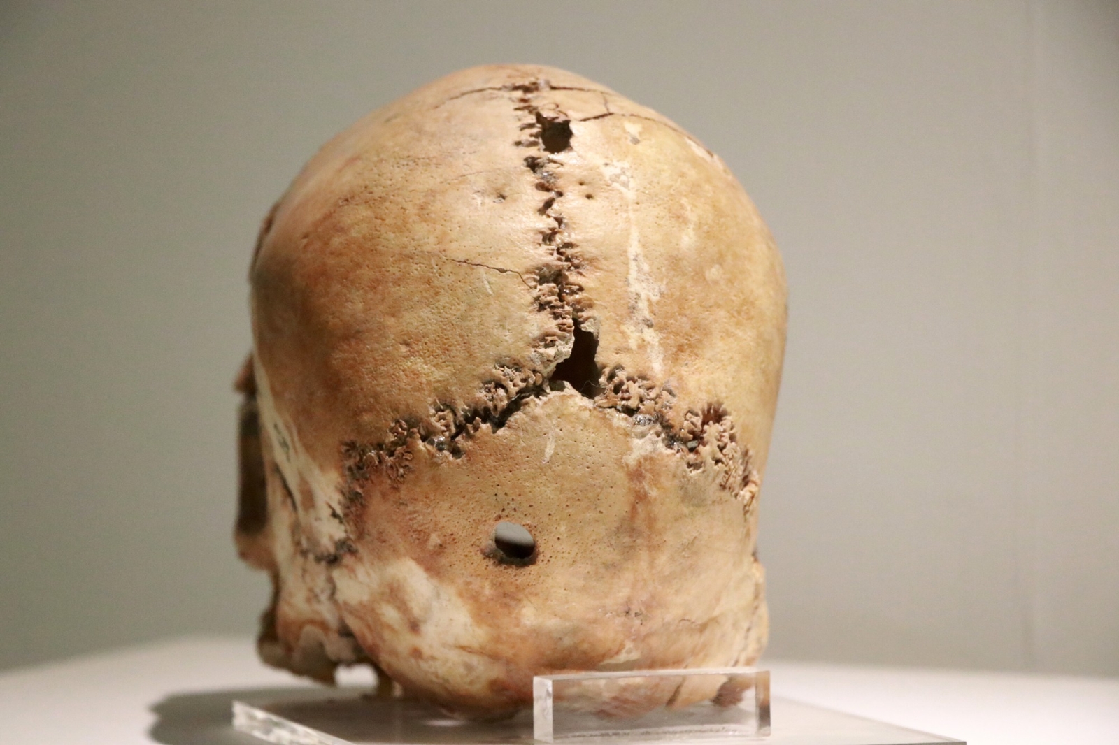 Dünyadaki ilk beyin ameliyatının yapıldığı Aşıklı Höyük 11 bin yıllık tarihe ışık tutuyor